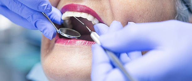 Best Emergency Treatment for Oral Infections in Basin, WY